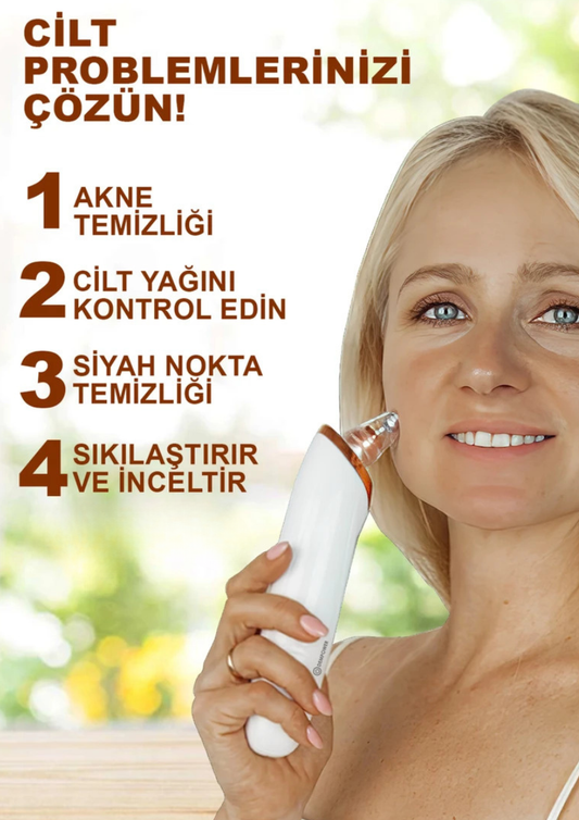 Mirello Siyah Nokta Temizleme Cihazı