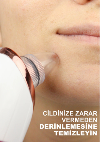 Mirello Siyah Nokta Temizleme Cihazı